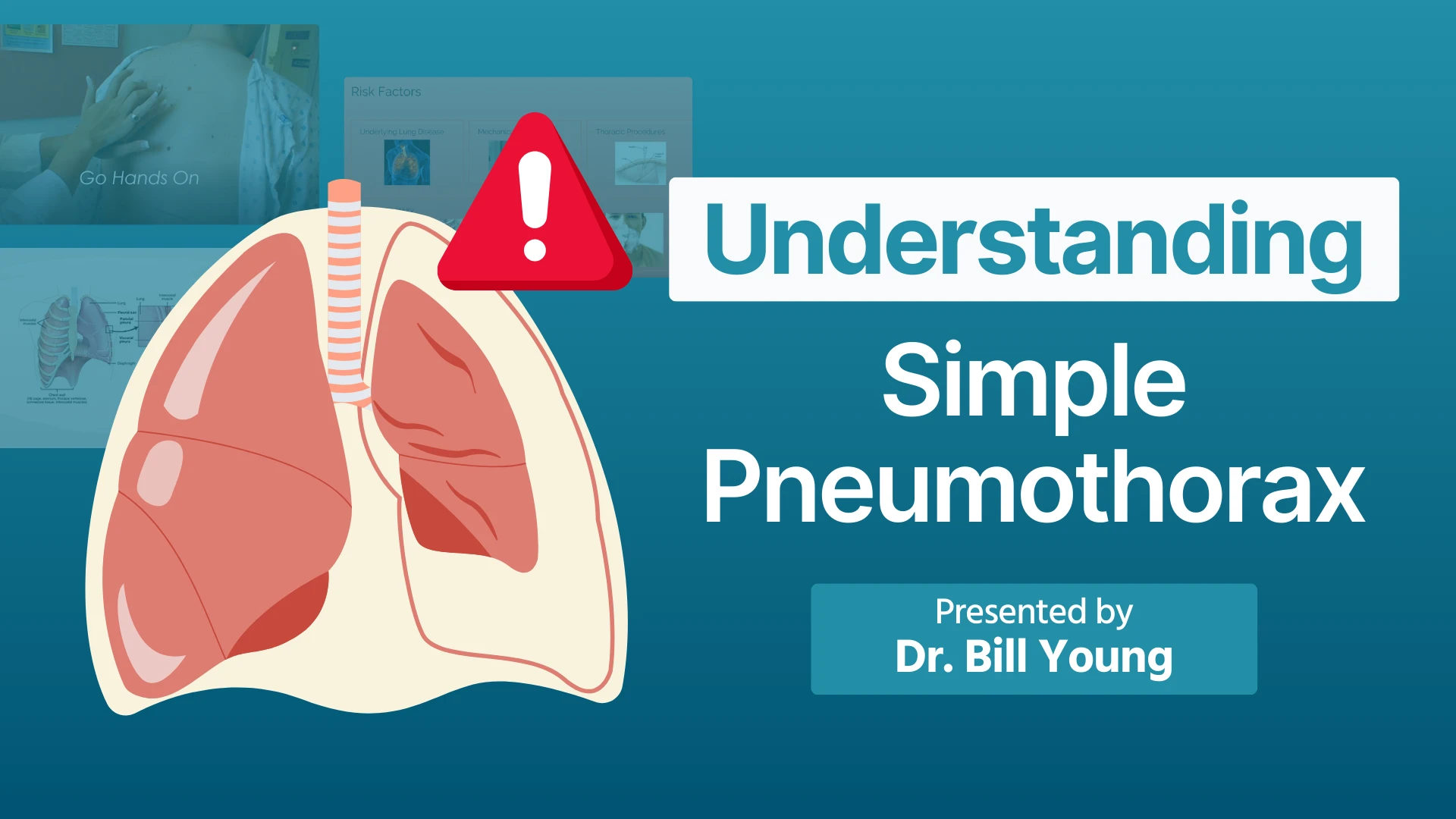 Understanding Simple Pneumothorax Thumbnail